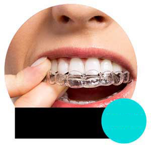 Leczenie bruksizmu Kraków nowość