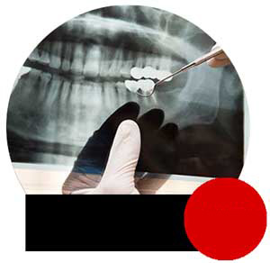 RTG pantomograficzne Kraków okazja